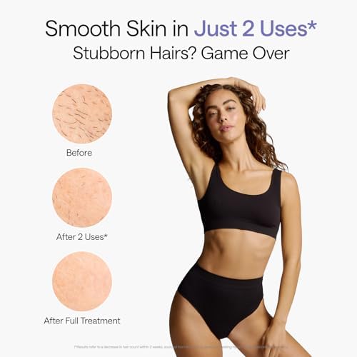 Ulike Laser Hair Removal, Air 10 IPL Hair Removal for Women and Men, 65F Ice-Cooling Contact, Dual Lights, Skin Sensor & SHR Mode* for Nearly Painless, Effective & Long-Lasting Hair Removal from Home